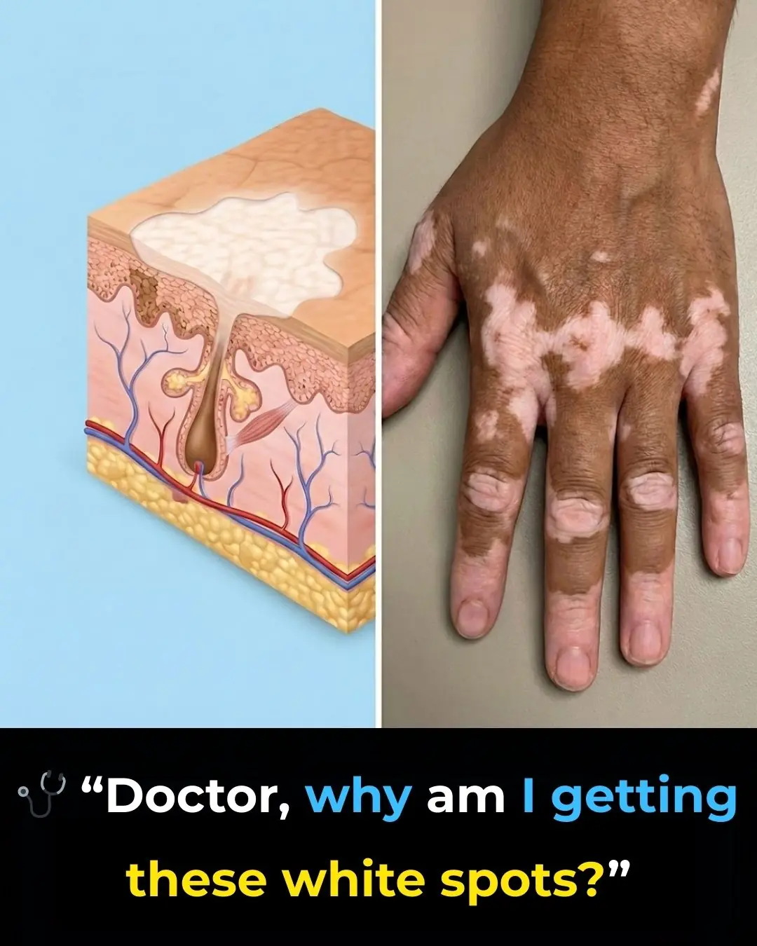 Understanding Vitiligo: Causes, Diagnosis, and the Importance of Medical Evaluation