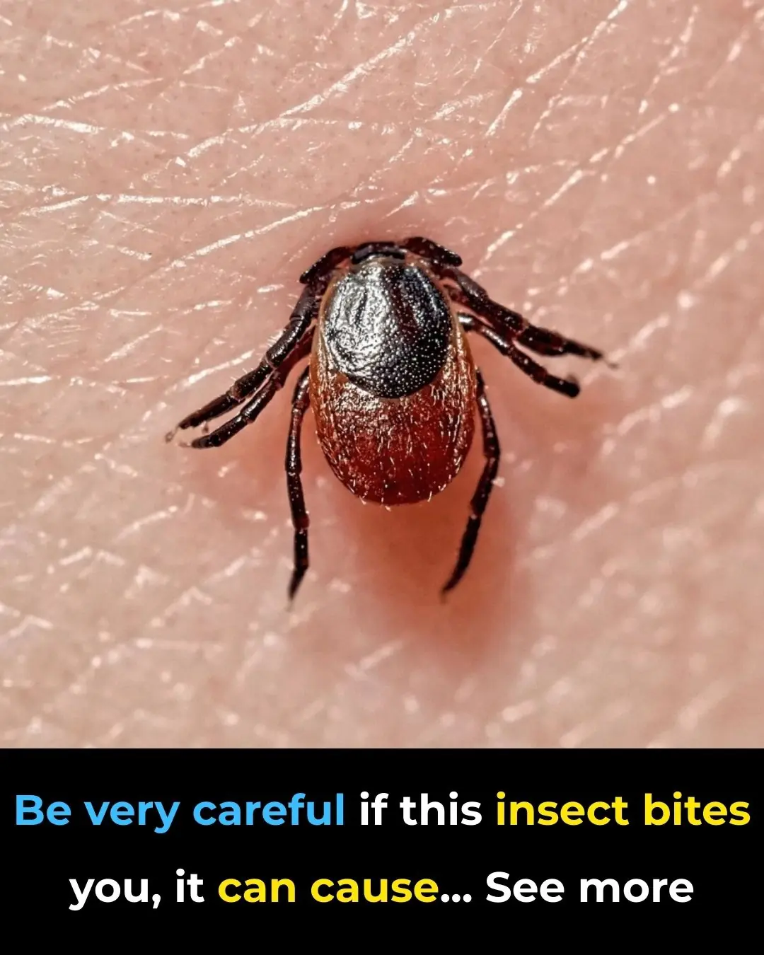 Lyme disease: causes, natural treatment, and how to effectively prevent it