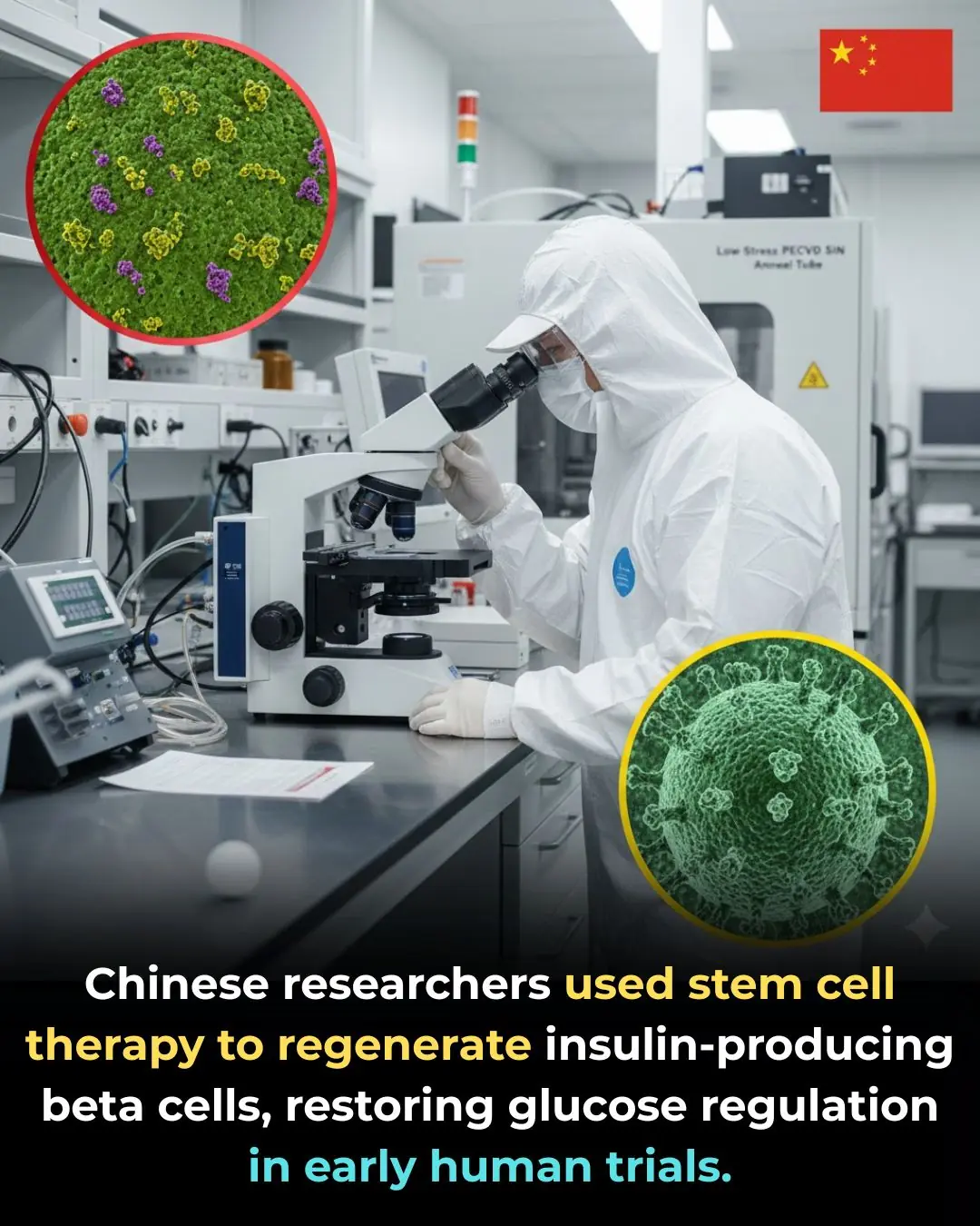 Stem Cell Therapy for Diabetes: A Potential Breakthrough