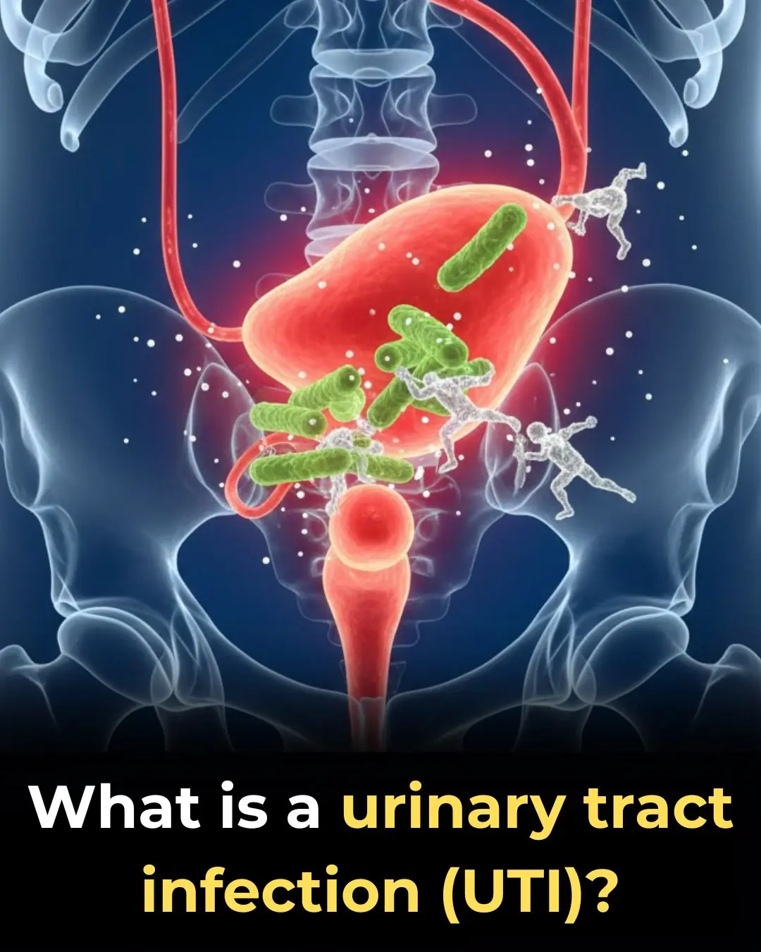 What Is a Urinary Tract Infection (UTI)? Symptoms, Causes, and Prevention
