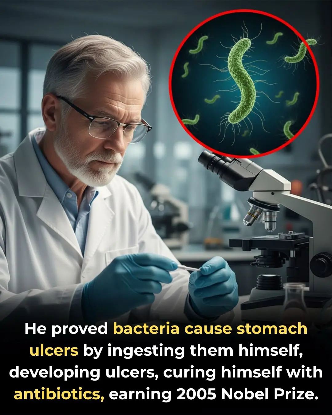 How Helicobacter pylori Revolutionized the Understanding of Stomach Ulcers