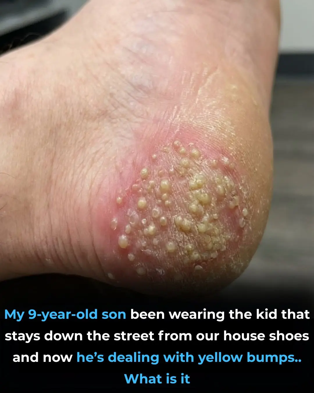 These are the consequences of wearing used…