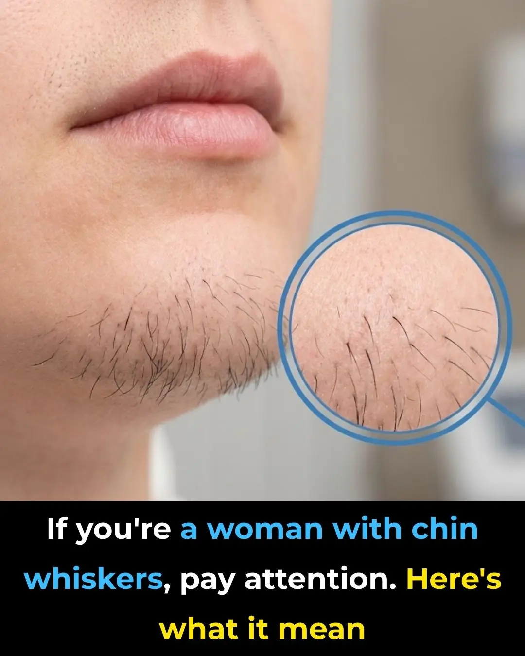If you're a woman with chin whiskers, pay attention. Here's what it means