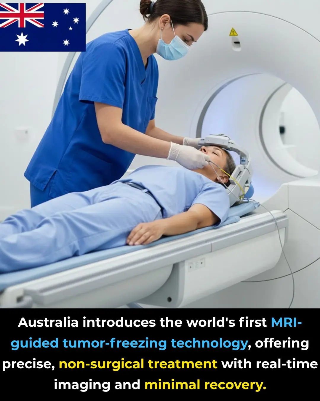 MRI-Guided Cryoablation: Australia’s Breakthrough in Non-Surgical Tumor Treatment
