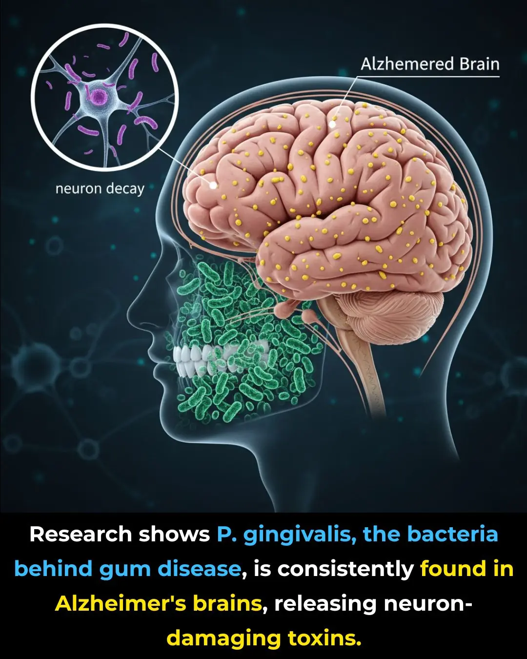Oral Health and Dementia: The Hidden Connection