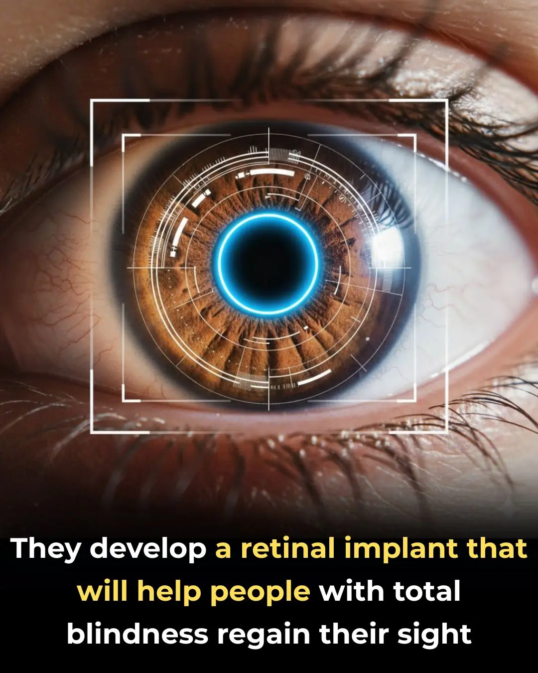 A promising retinal implant could restore sight to blind patients