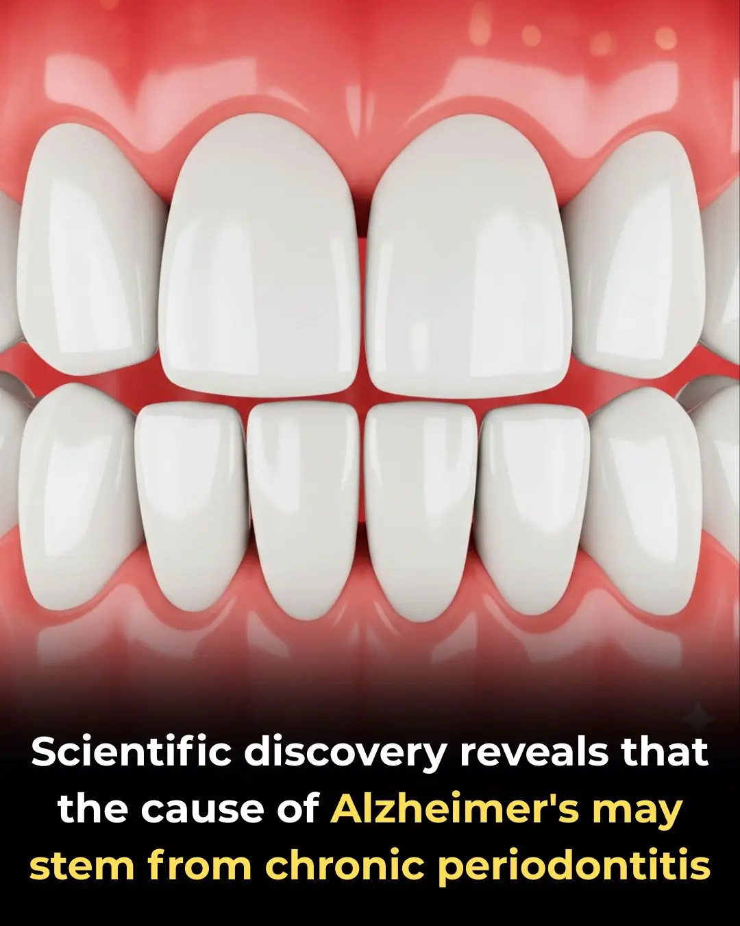 Scientific discovery reveals that the cause of Alzheimer's could originate in your mouth