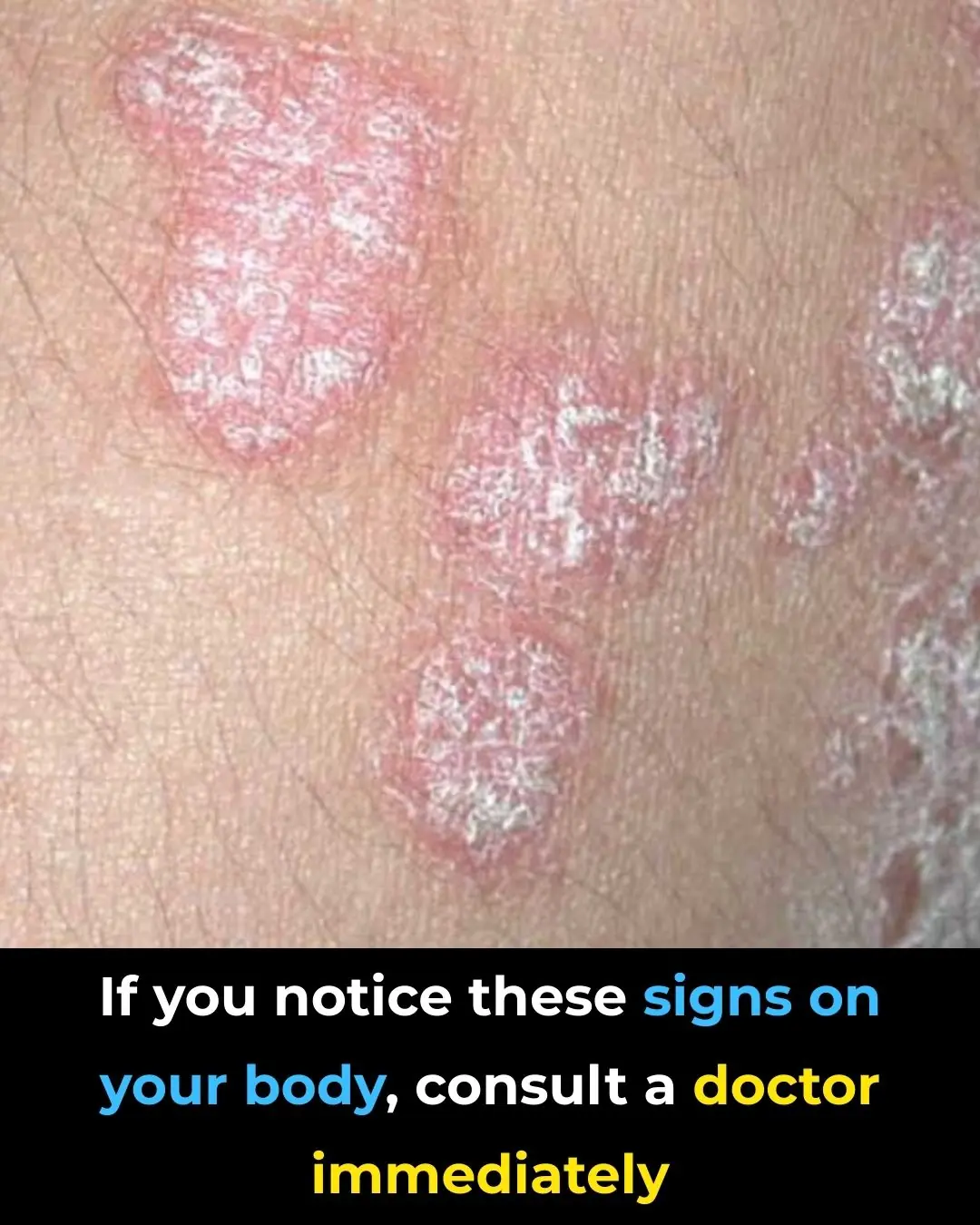 If you notice these signs on your body, consult a doctor immediately