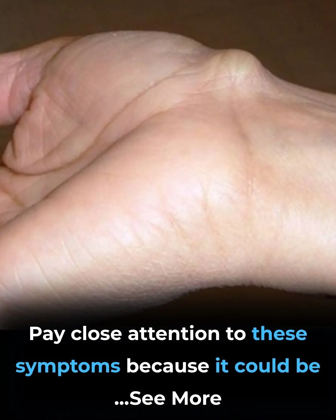 Do you have a lump on your wrist? Pay close attention to these symptoms, don't ignore them
