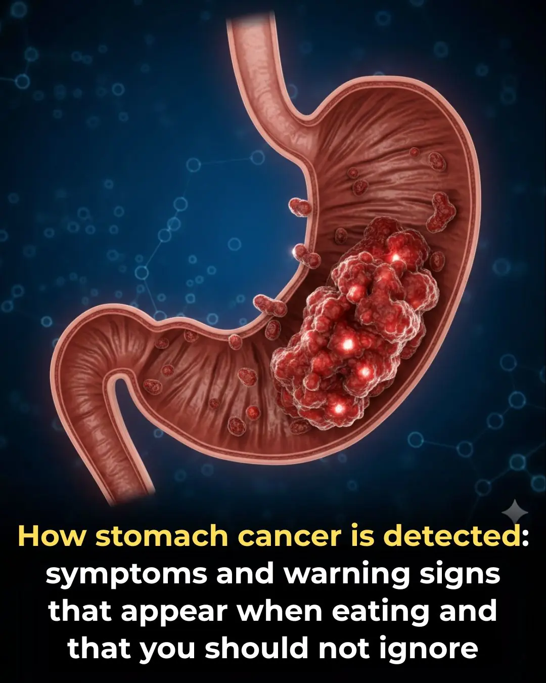 This is how stomach cancer is detected: symptoms and warning signs that appear when eating and that you shouldn't ignore