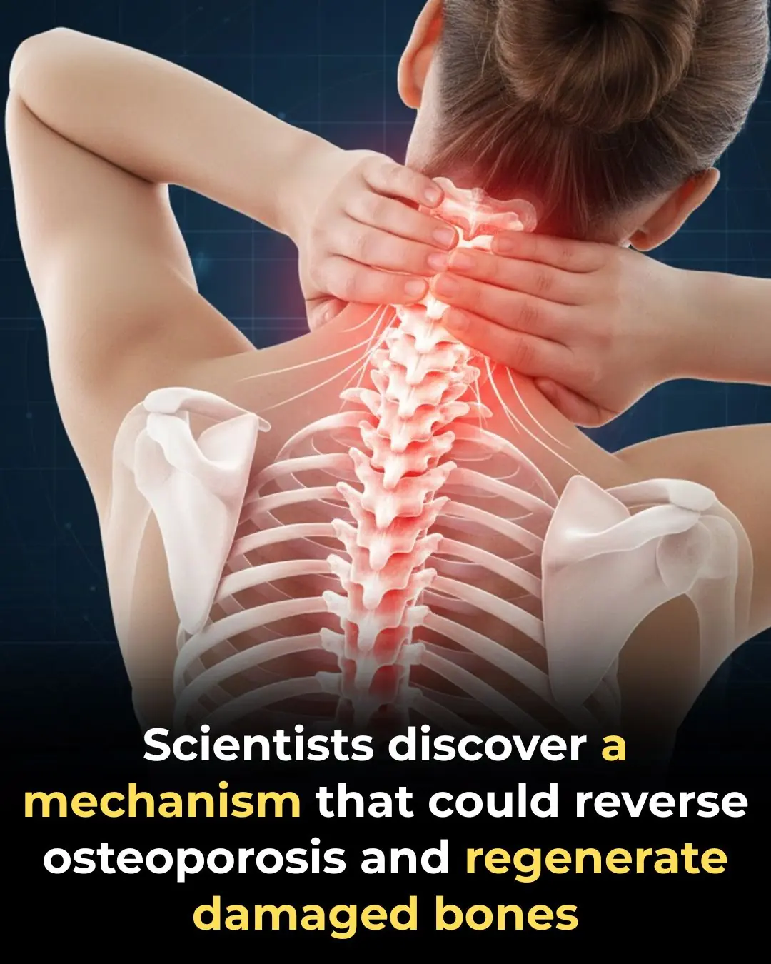 Breakthrough against osteoporosis: a mechanism identified that could reverse and regenerate damaged bones