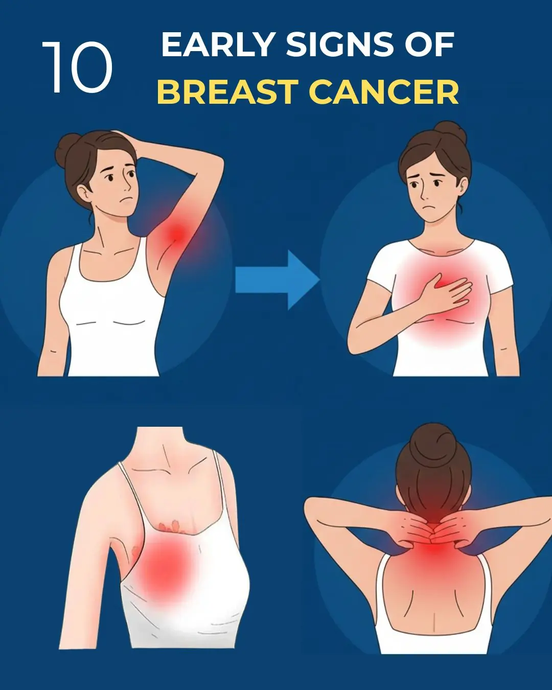 10 Warning Signs of Breast Cancer You Should Never Ignore
