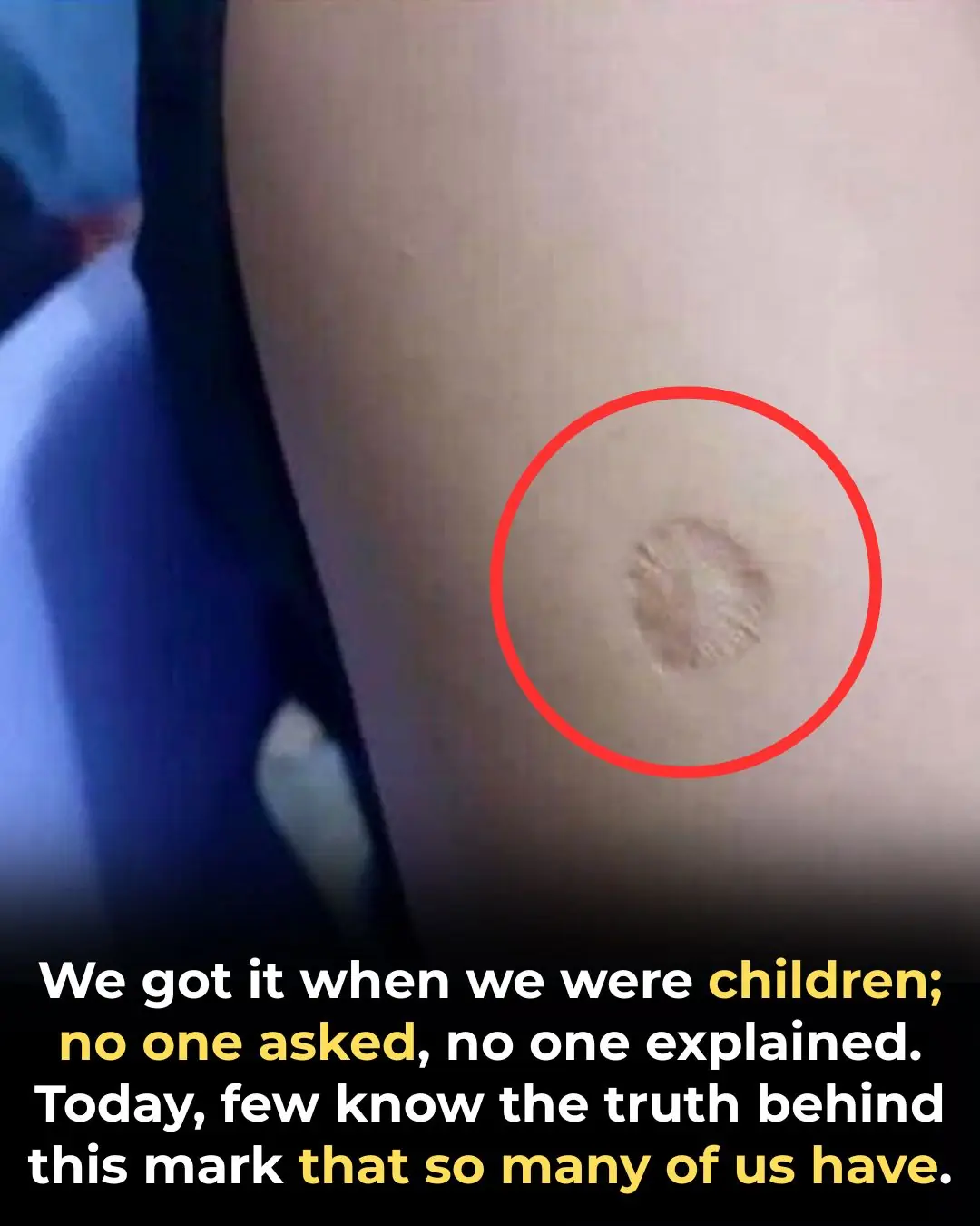The Small Round Scar on Your Arm