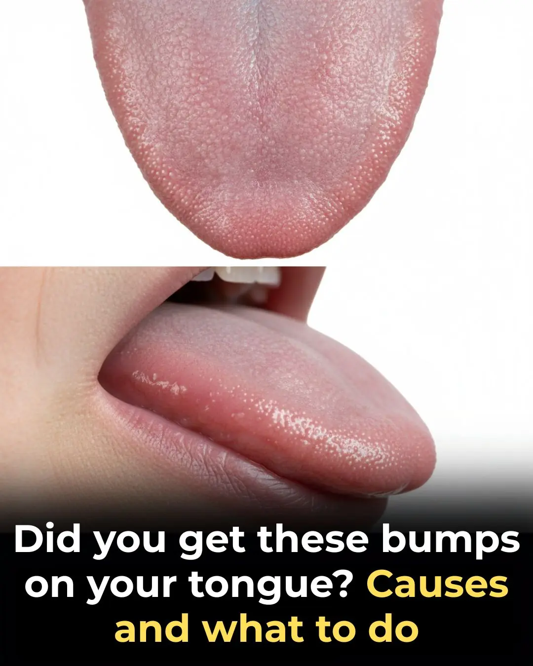 If you have bumps on your tongue, your body is trying to tell you something very important
