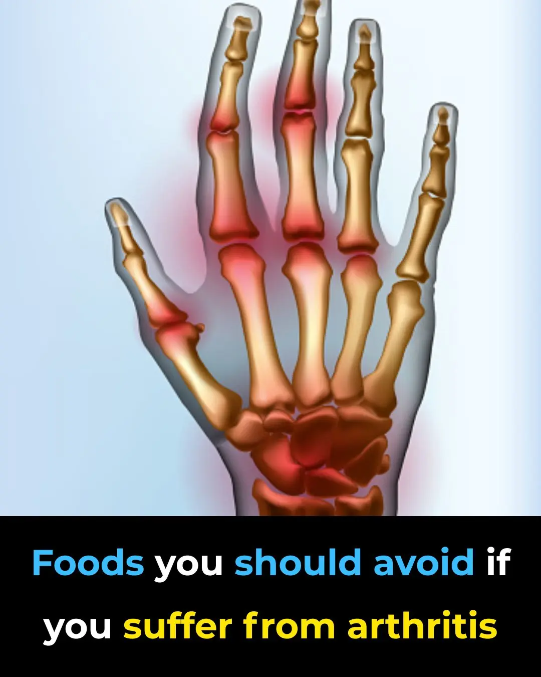 Avoid These Foods to Help Prevent and Relieve Arthritis Discomfort