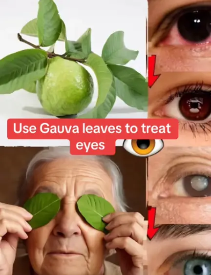 How to use guava to treat eye problems — natural remedies for the eyes