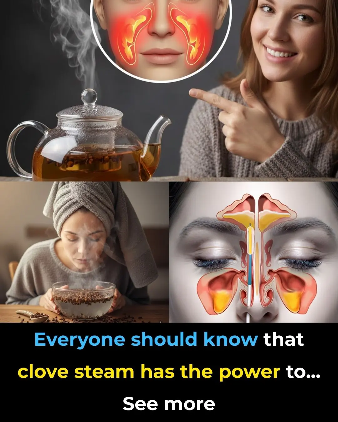 🌿 Clove Steam Inhalation for Sinus Relief: A Soothing Home Remedy—Done Safely & Effectively