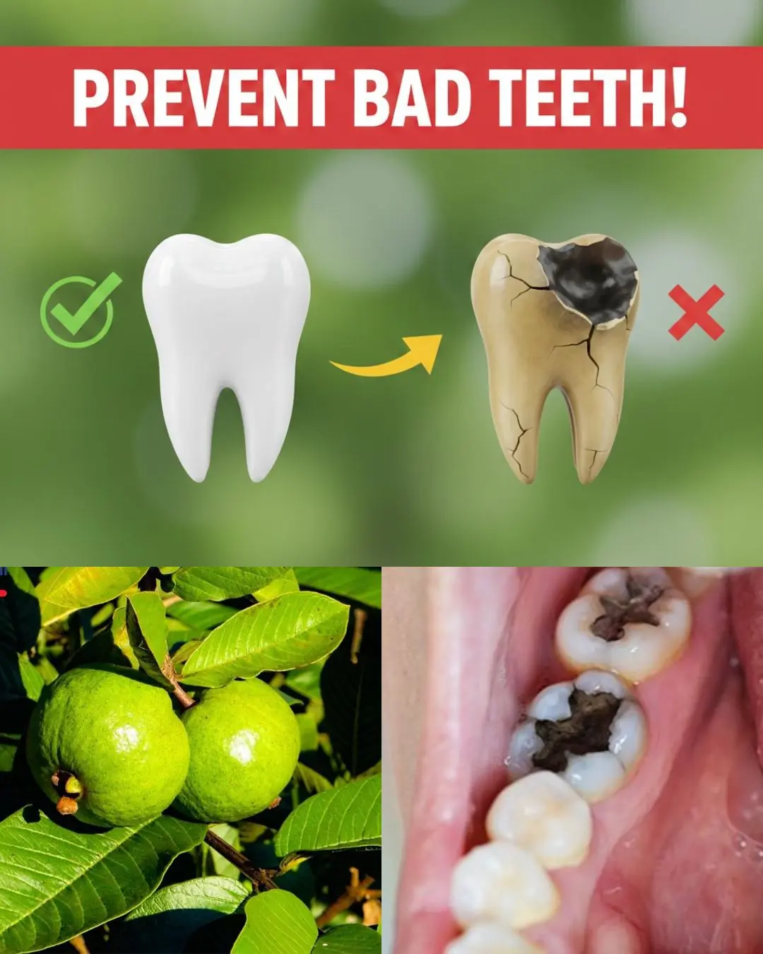 Did You Know 92% of Americans Over 50 Have At Least One Cavity Right Now—While This One Backyard Leaf Is Quietly Reversing Decay Without a Single Drill?