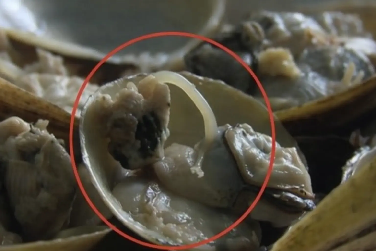 Two People Stopped Breathing After Eating Oysters Infected With a Flesh-Eating Bacteria — Doctors Issue Urgent Warning