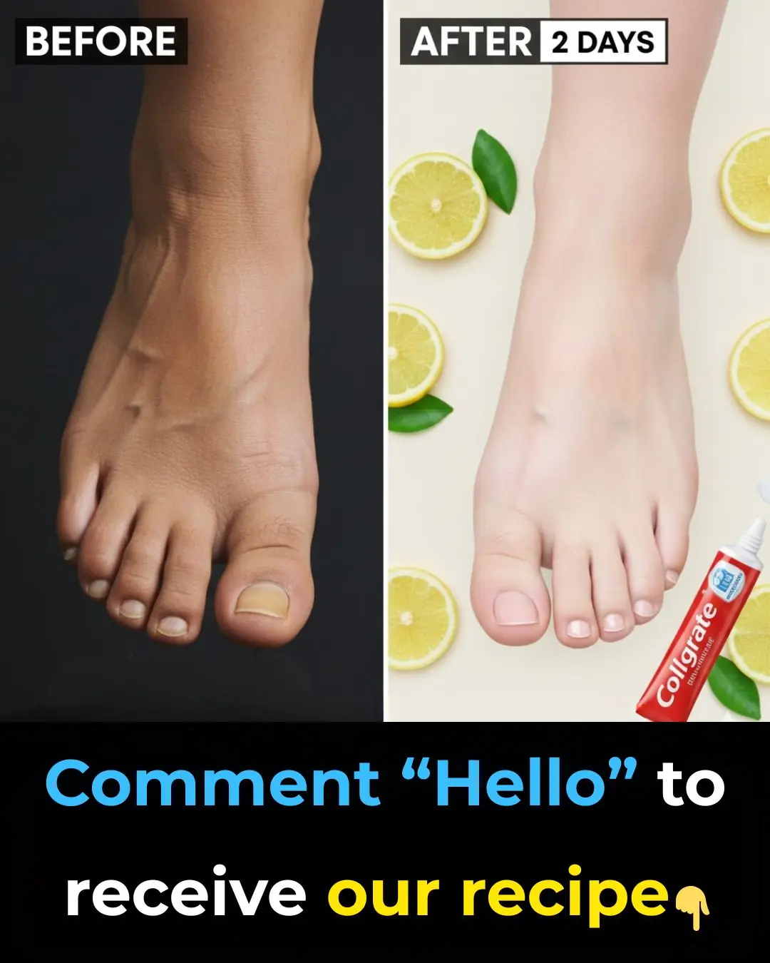 How I Improved the Appearance of My Legs: Smoother, Brighter & Healthier-Looking Skin with Simple Habits