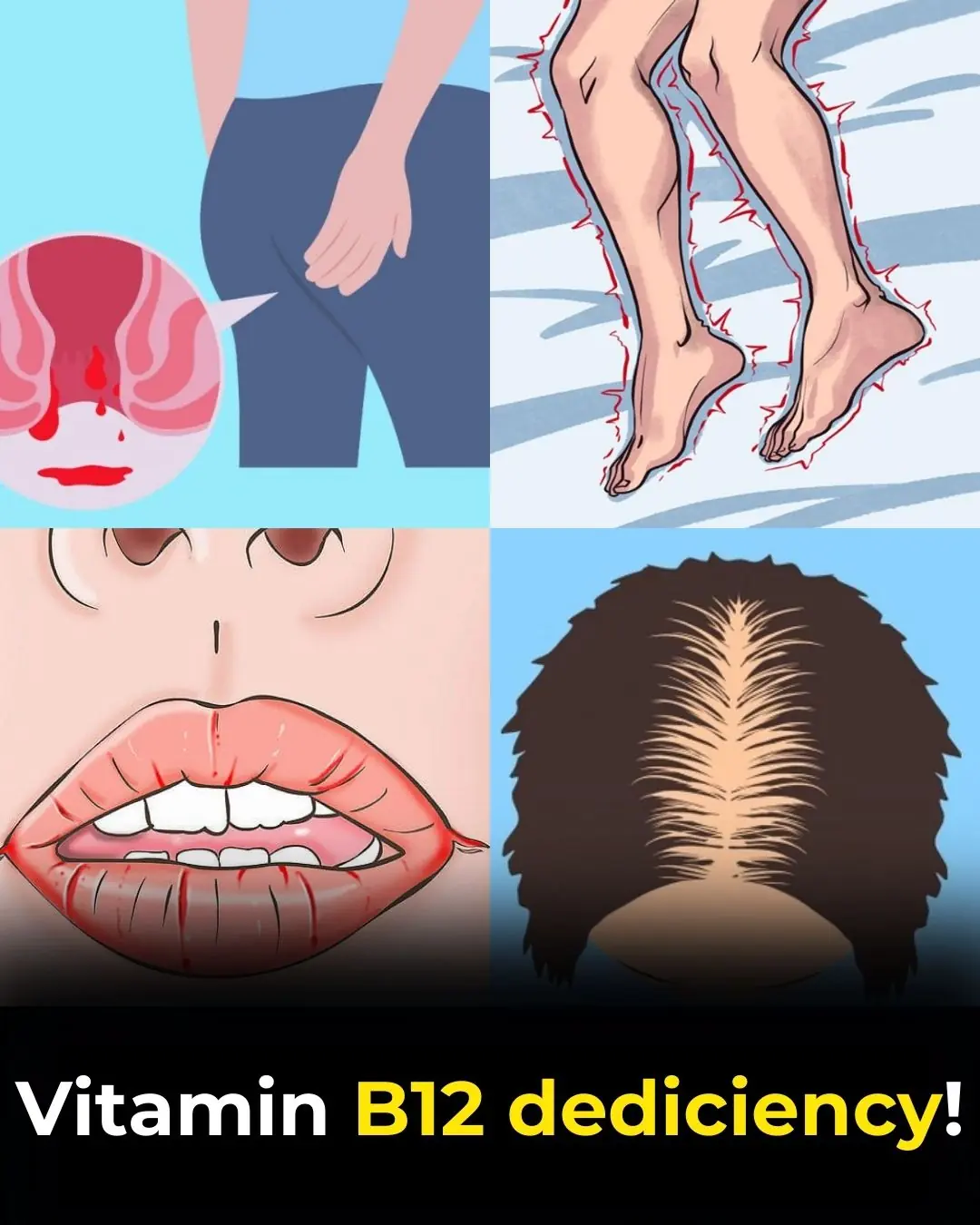 🧠 8 Strange (But Real) Signs Your Body Is Begging for More Vitamin B12 – Don’t Ignore These Red Flags