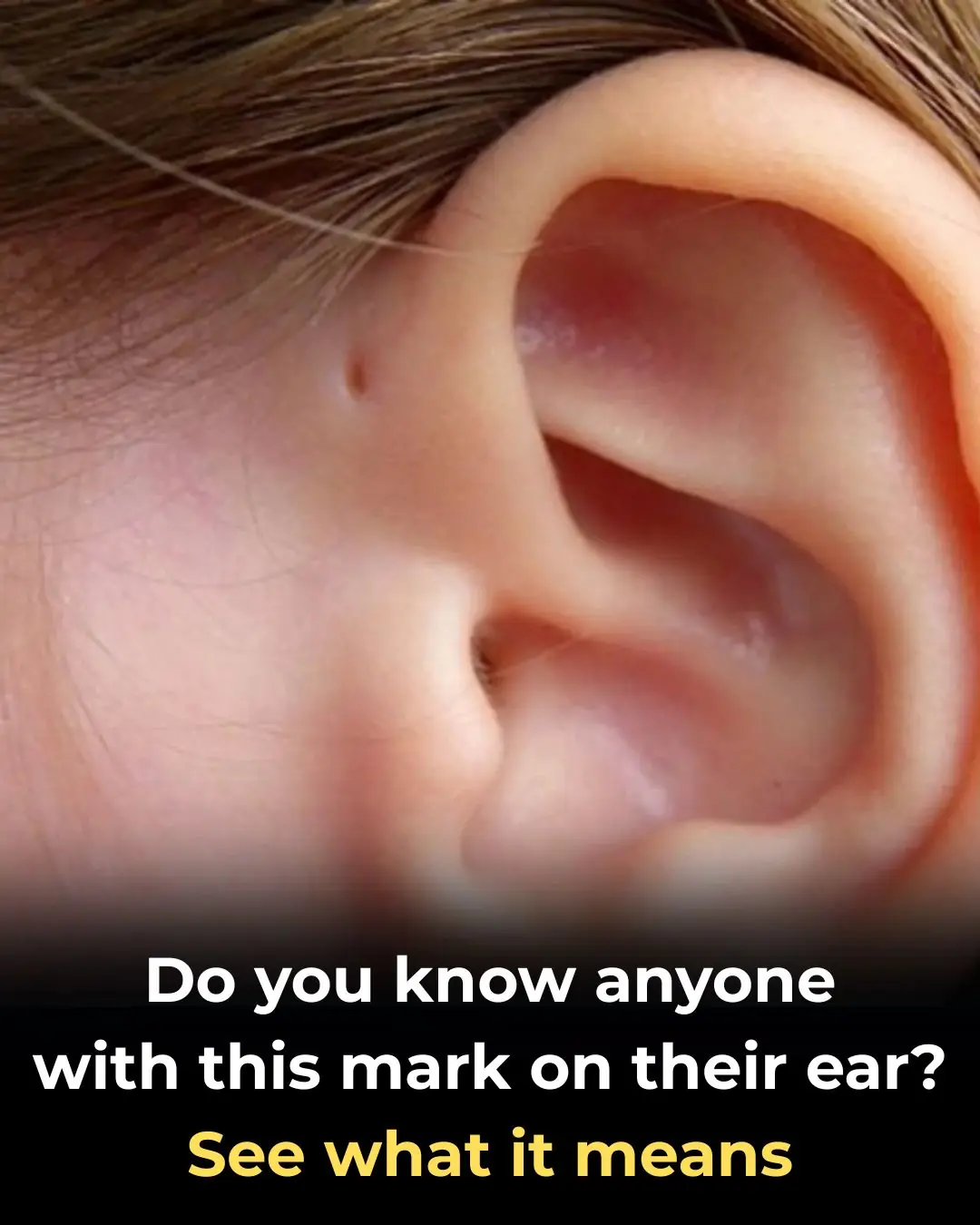 Here is what this little hole on the ear mean