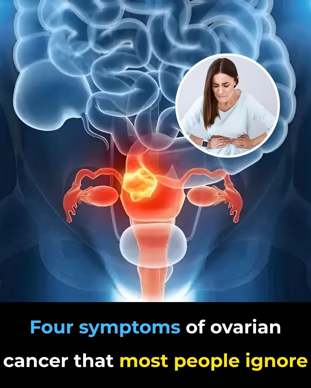 Early Symptoms of Ovarian Cancer