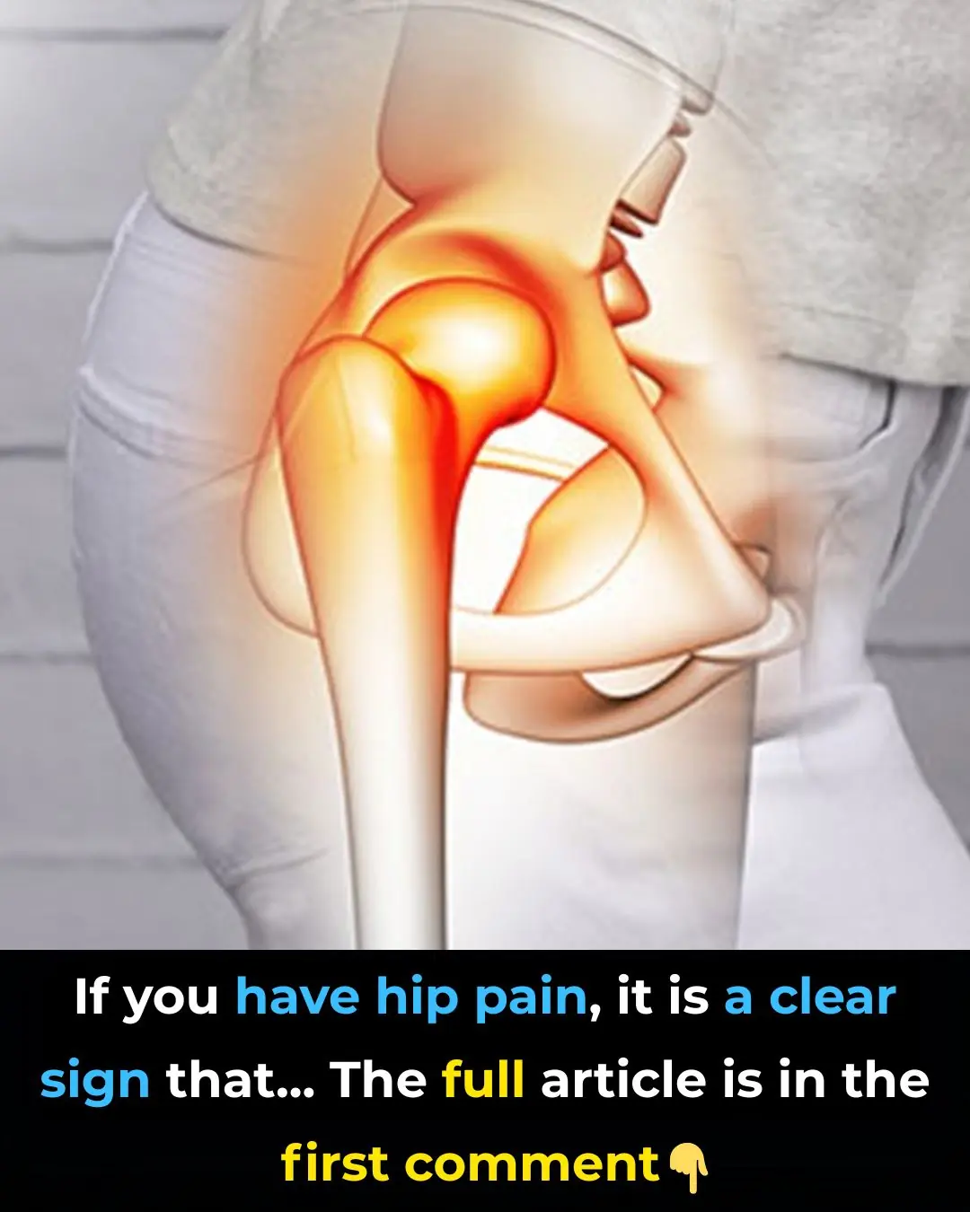 🦴 Hip Pain: What Does It Mean? Common Causes & When to Seek Help