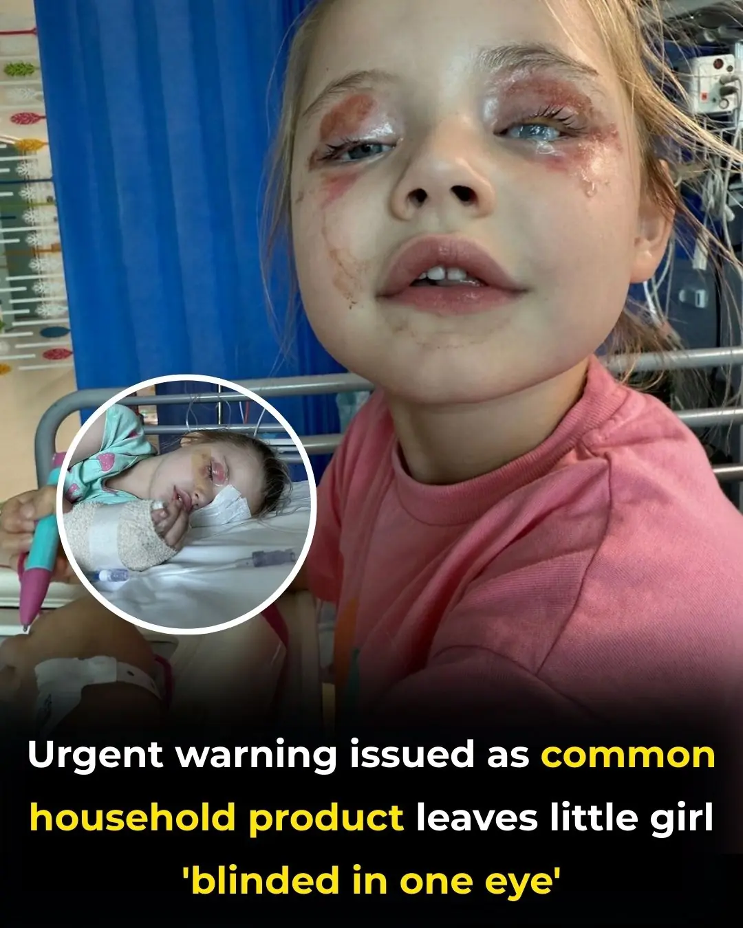 Parents Warn of Hidden Dangers After Detergent Pod Injures Daughter’s Eye