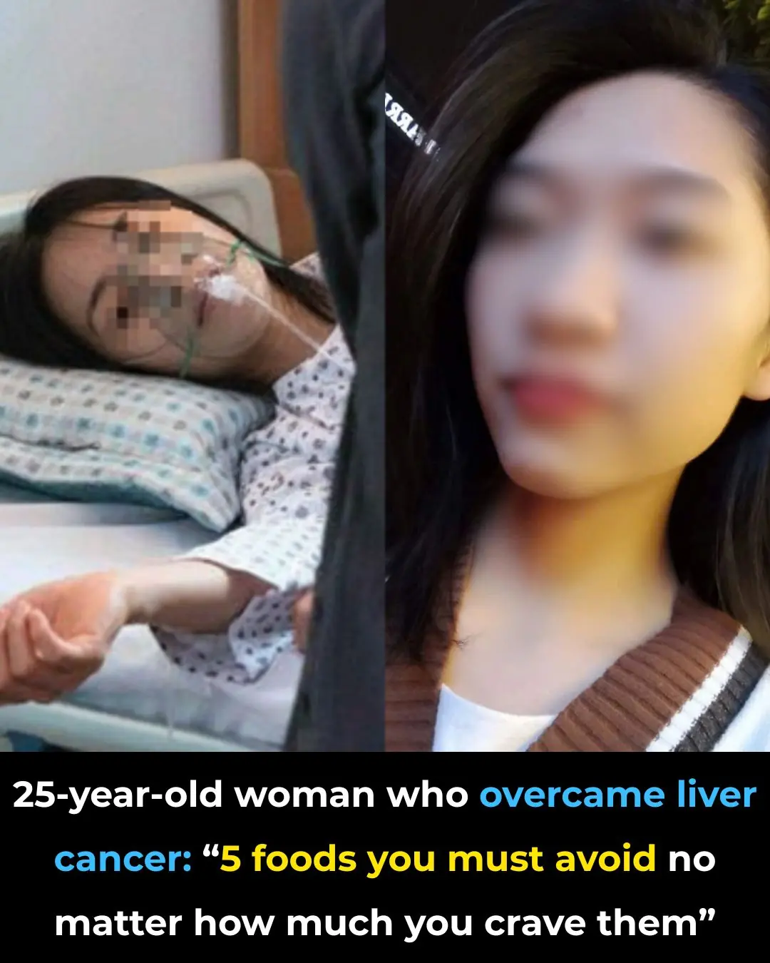 A 25-Year-Old Liver Cancer Survivor Shares: “5 Foods You Must Avoid — No Matter How Much You Crave Them”