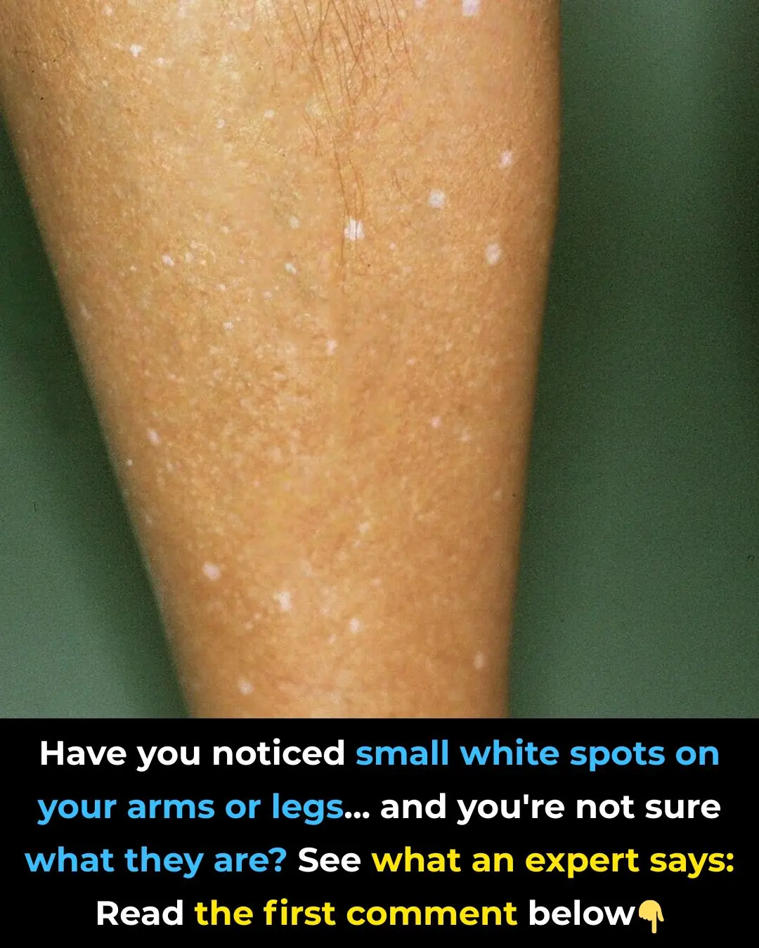White Spots on the Skin: Causes, Types, and When to See a Doctor