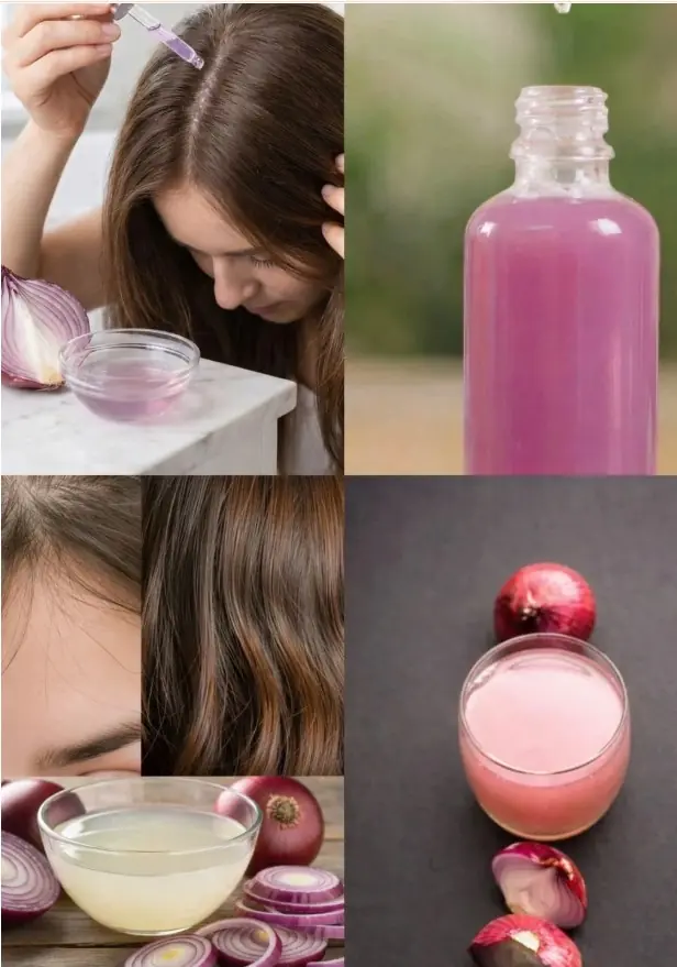 How to Grow Long, Thicken Hair with Onion (Natural Hair Growth Secret!)