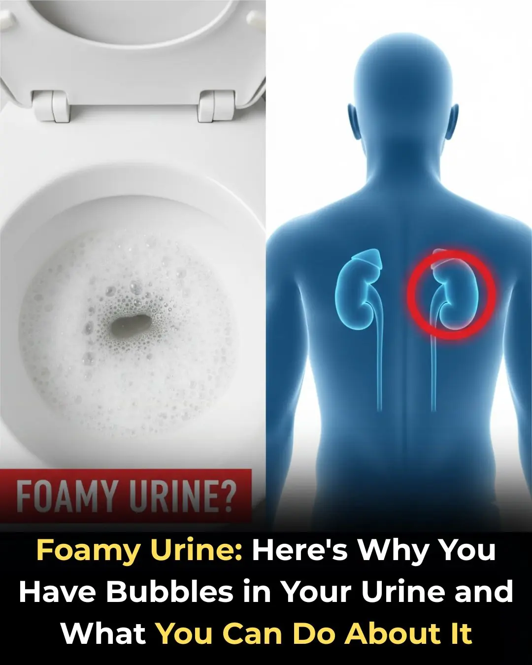 Foamy Urine: Here’s Why You Have Bubbles in Your Urine