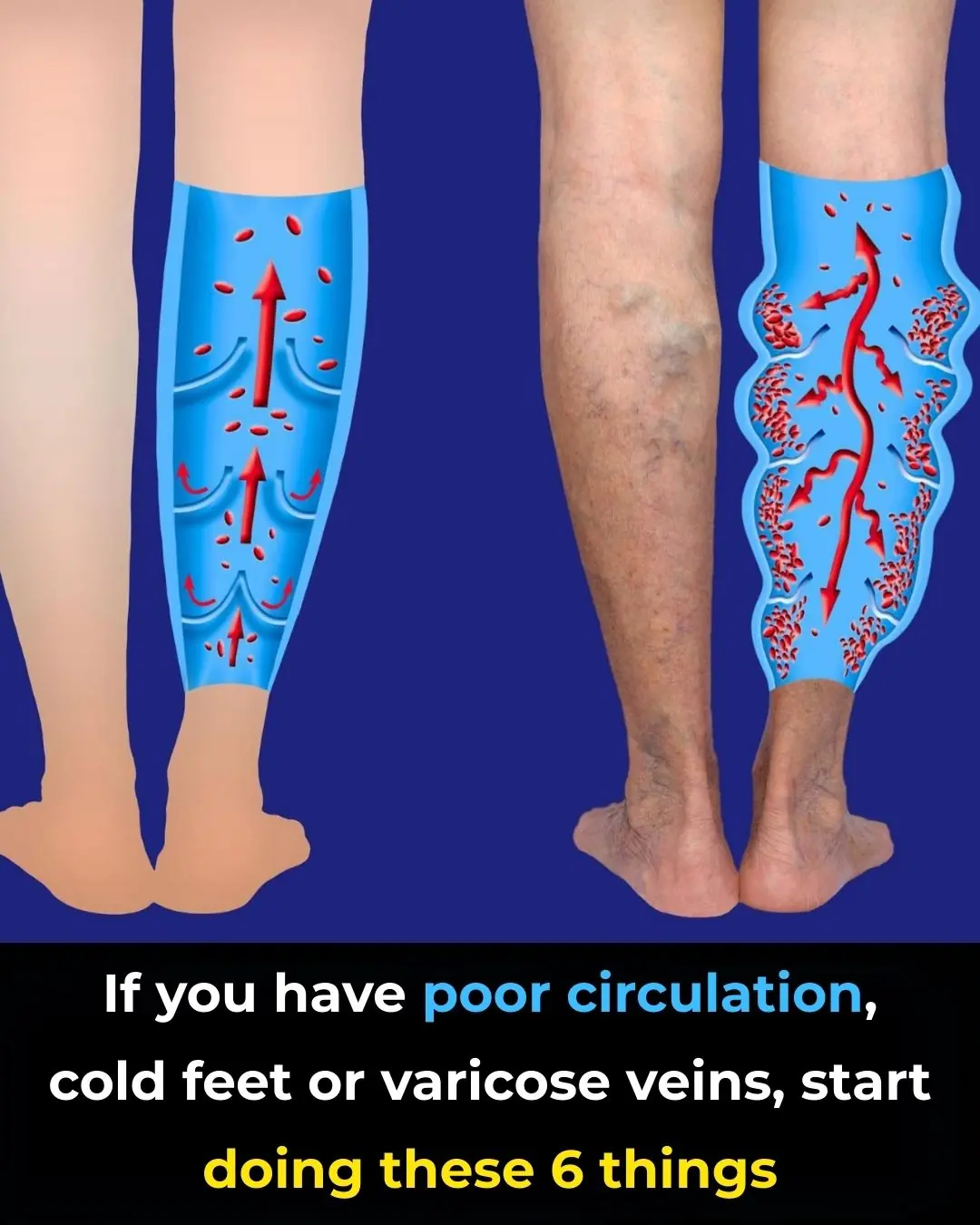 Simple Ways to Improve Circulation
