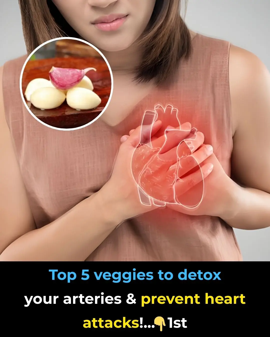 Top 5 Veggies to Detox Your Arteries and Prevent Heart Attacks!