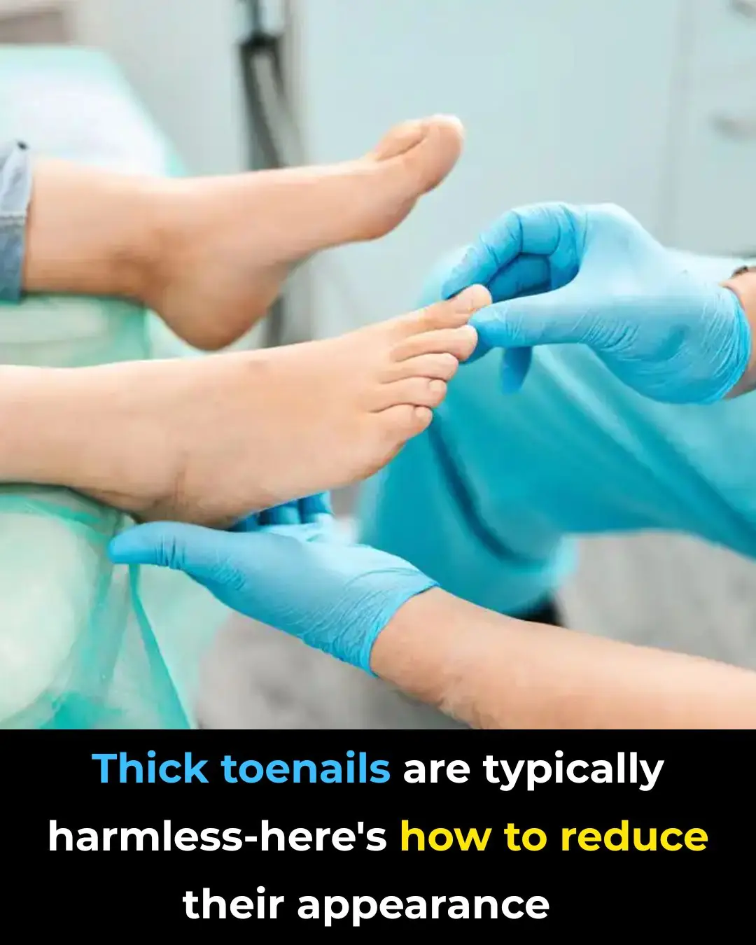 Why Do You Get Thick Toenails?