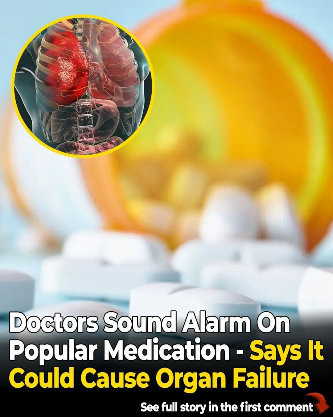 Doctor Warns Popular Medication May Lead to Organ Failure
