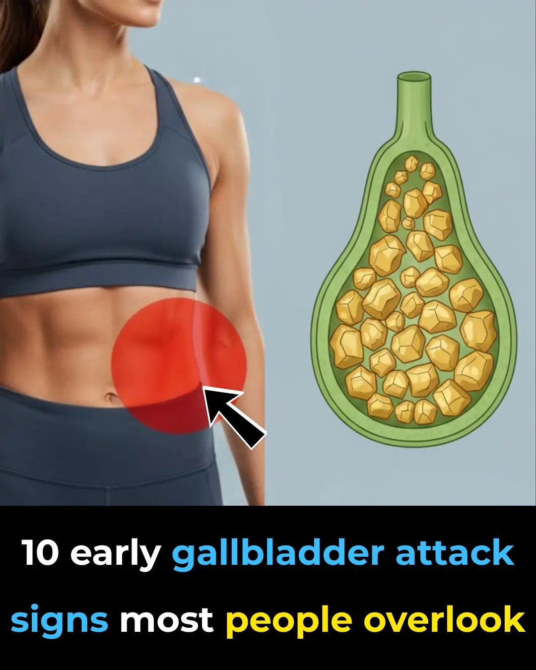 Top 10 signs of a gallbladder attack
