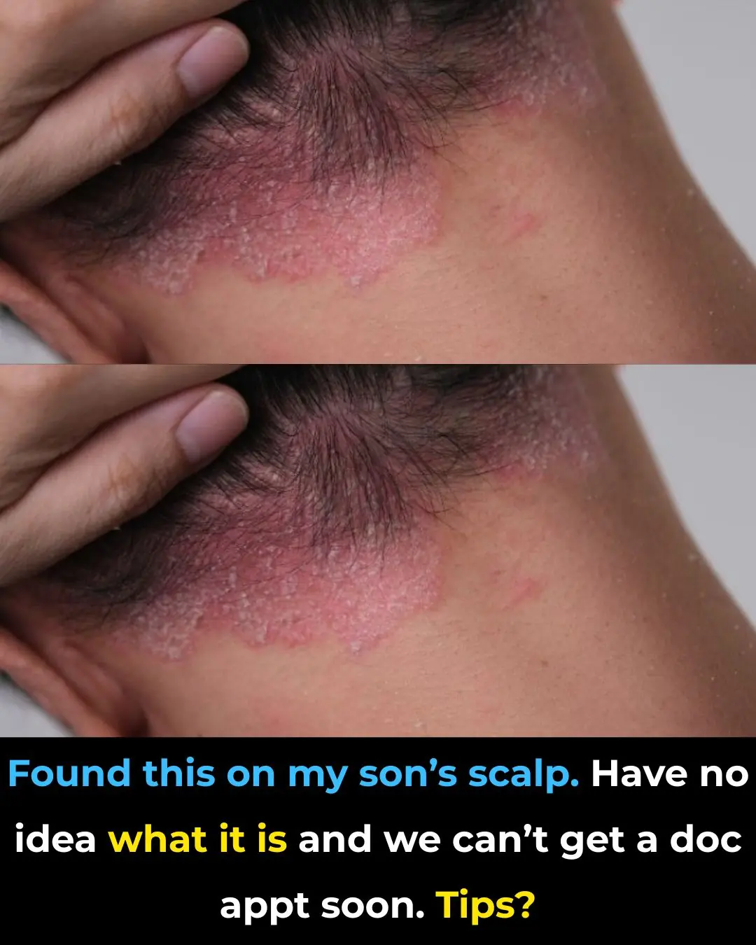 Found this on my son’s scalp. Have no idea what it is and we can’t get a doc appt soon. Tips?