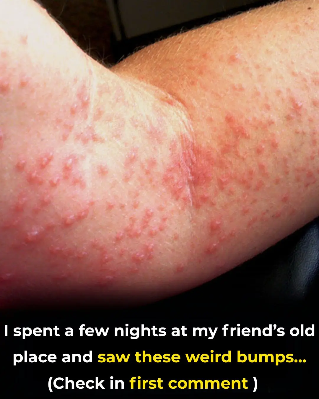 I spent a couple of nights at my friend’s previous apartment and saw these unusual bumps