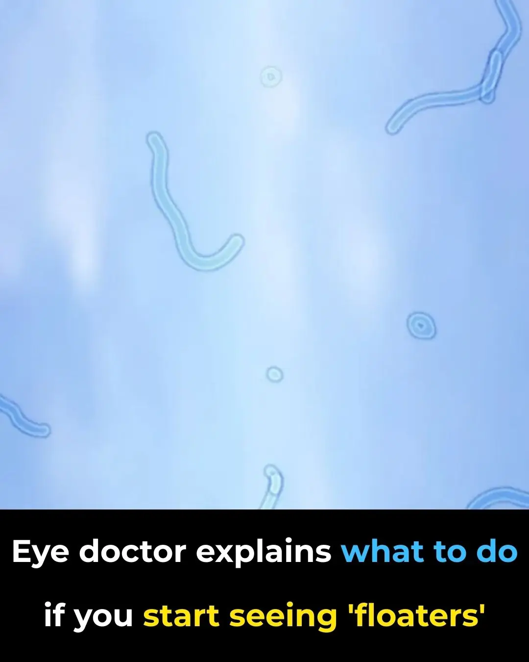 What Are Eye Floaters? Here What To Do If you Start Seeing Them, According to an Eye Doctor