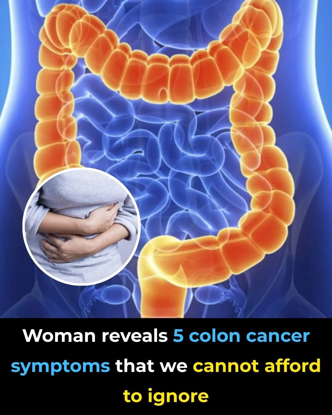 Woman reveals five colon cancer symptoms that should not be ignored