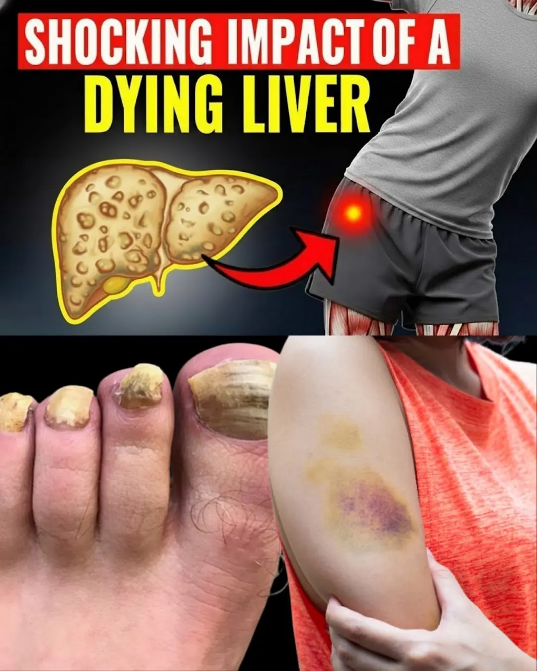 15 Strange Early Signs of Liver Failure That Even Doctors Often Miss