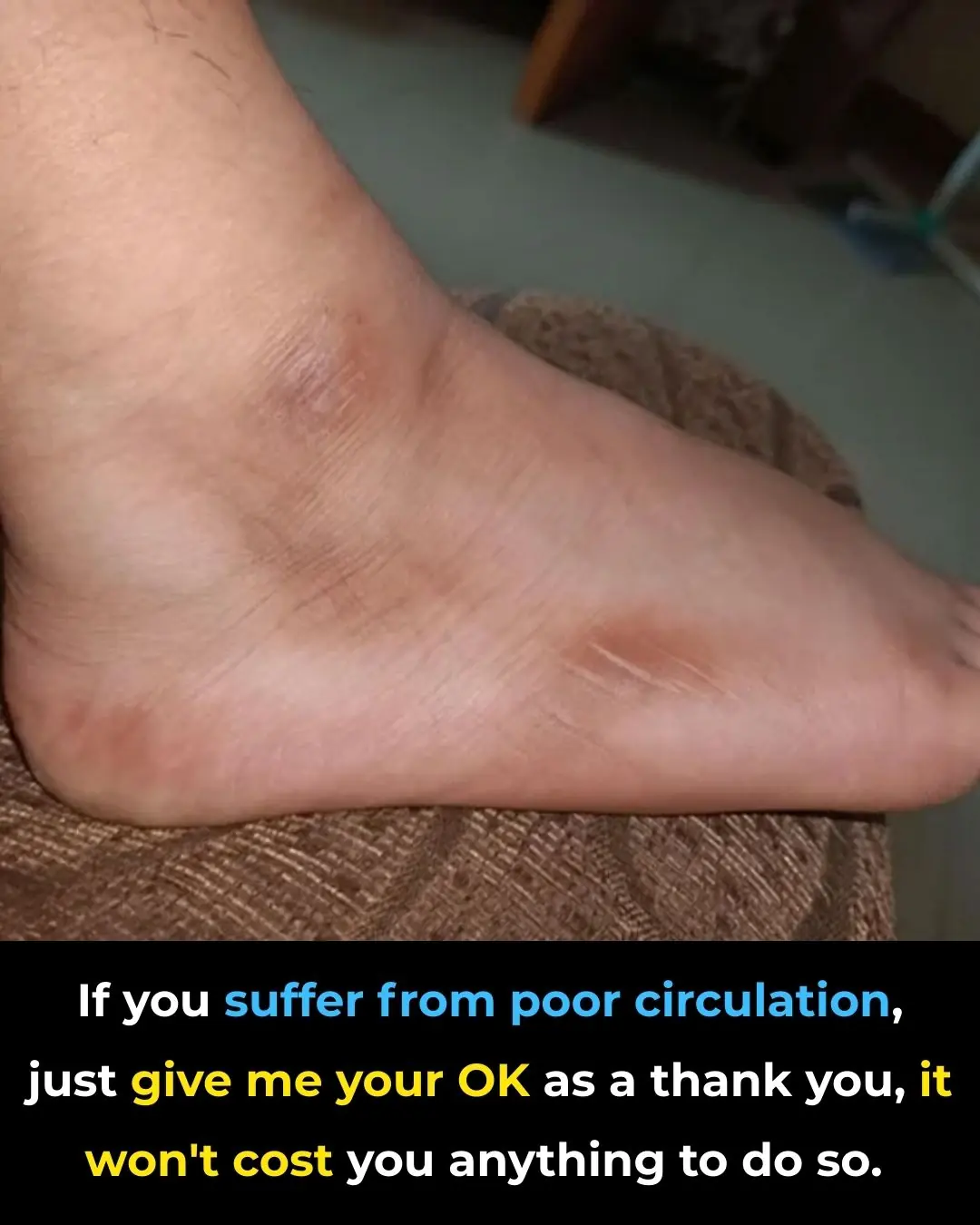 🩺 If Your Legs Feel Heavy, Cold, or Tingly—Here’s What It Means (And How to Improve Circulation Naturally)