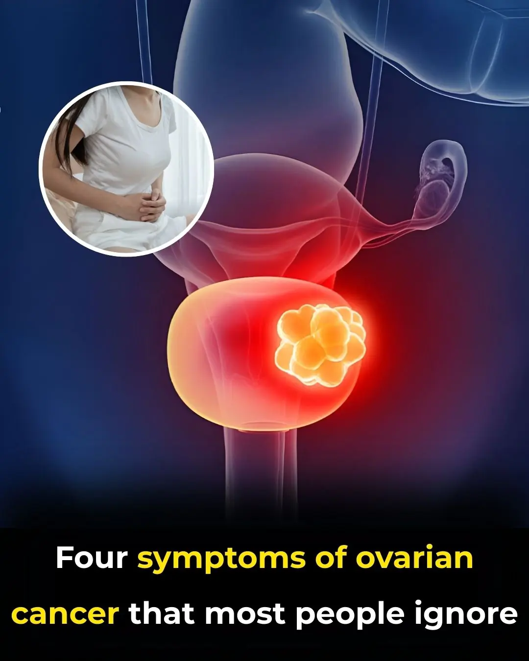 Early Symptoms of Ovarian Cancer