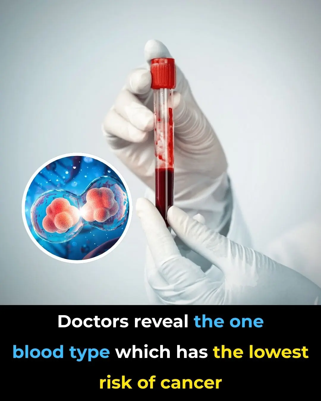 Understanding the Link Between Your Blood Type and Health