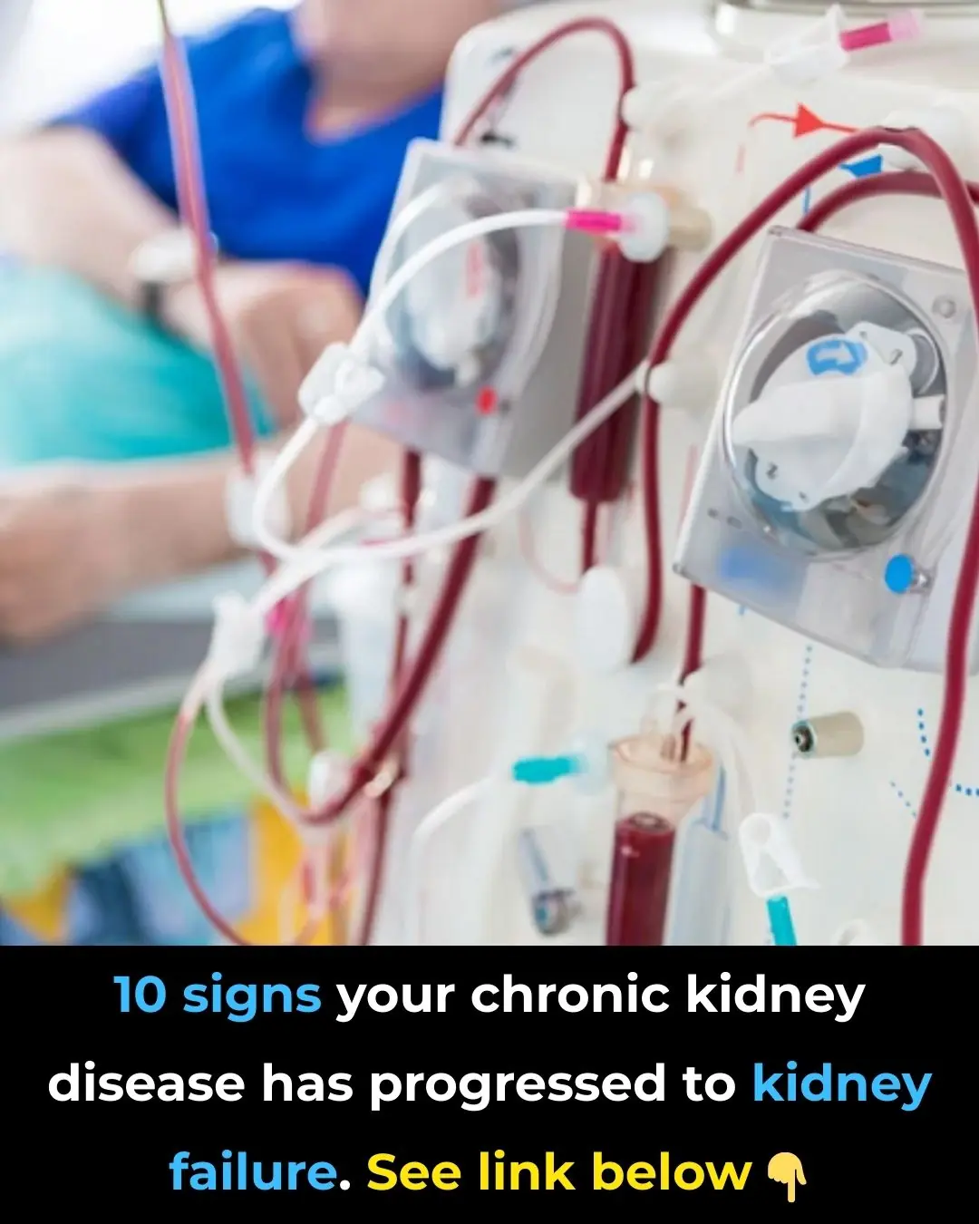 How To Recognize and Treat Chronic Kidney Failure