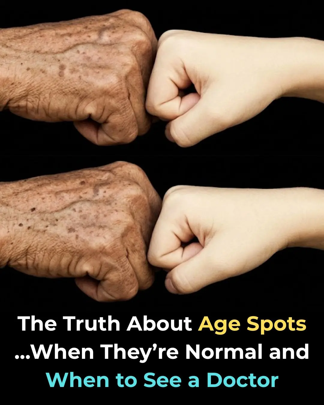 The Truth About Age Spots