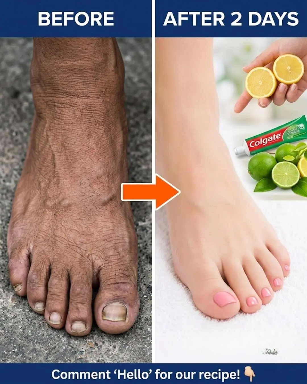 How I Improved the Appearance of My Legs: Smoother, Brighter & Healthier-Looking Skin with Simple Daily Habits