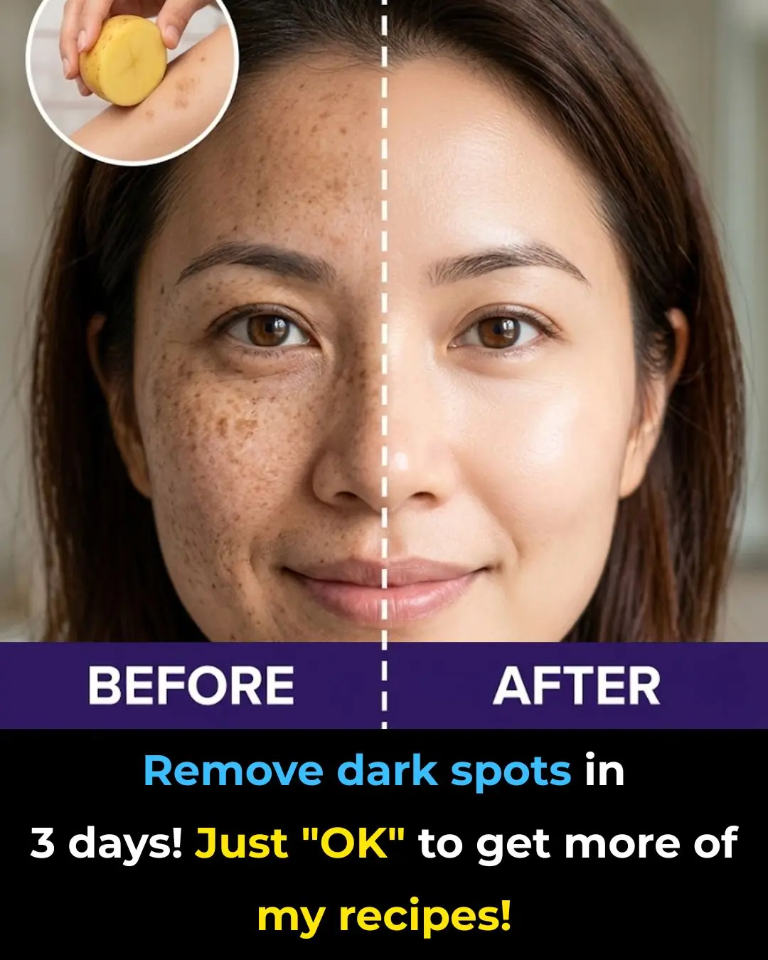 Naturally Softening the Appearance of Age Spots: A Simple DIY Mask with Cornstarch, Baking Soda, and Lemon for Brighter-Looking Skin